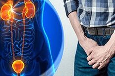 Symptome einer Prostatitis